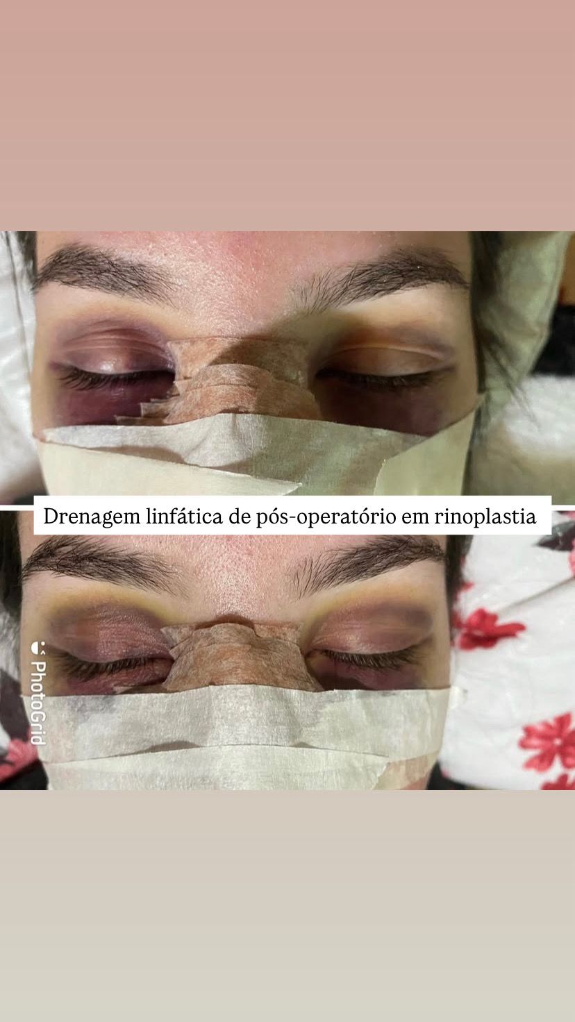 Je Stética