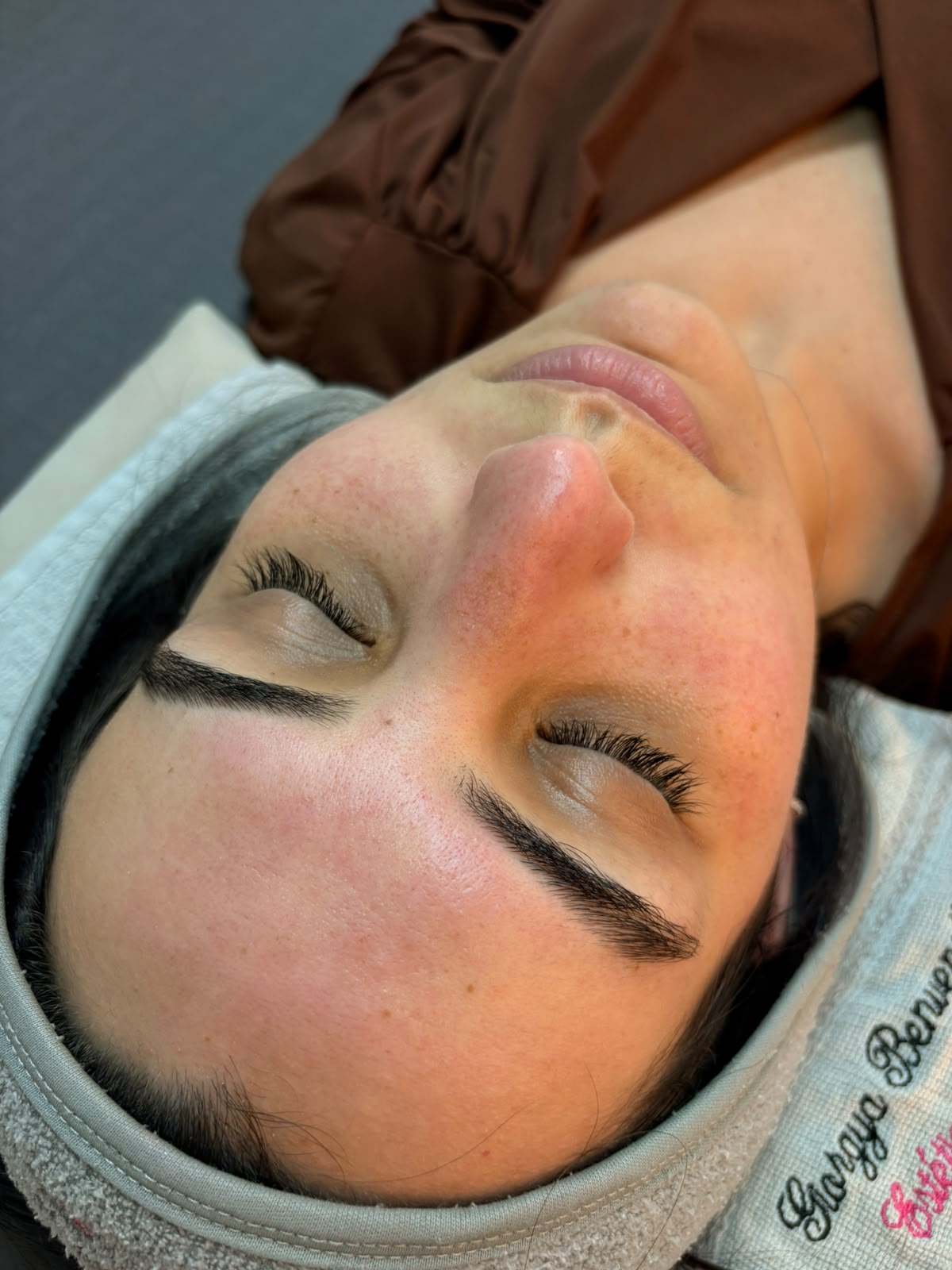 Limpeza de Pele